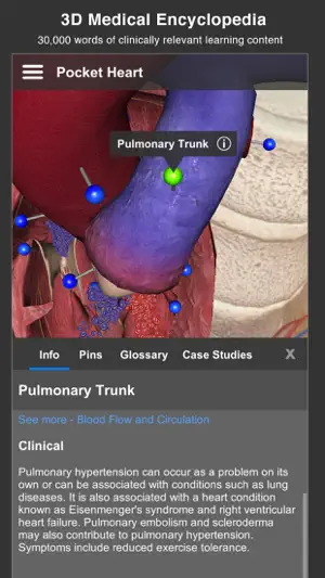Pocket Heart - 交互式心脏病学